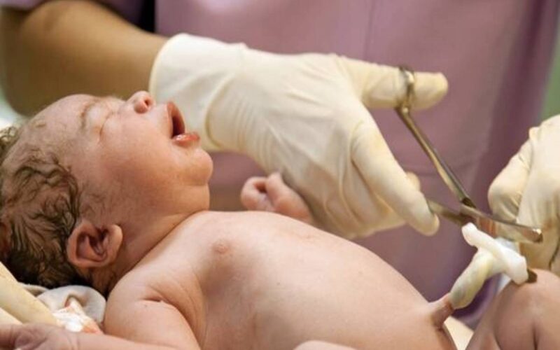 تخزين الحبل السري للمولود لاستخدامه فيما بعد في علاجه.. جائز شرعًا