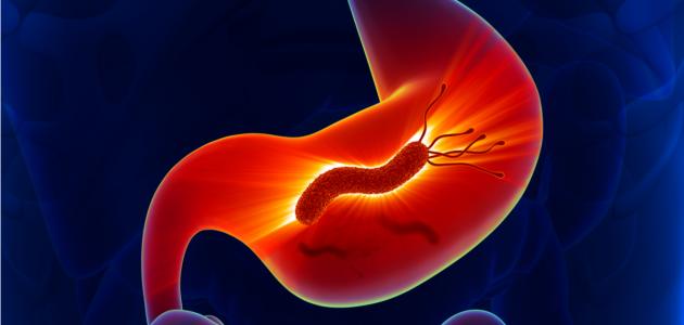 11 طريقة طبيعية للتخلص من جرثومة المعدة.. تعرف عليها