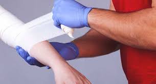 ترقيع الجلد التالف للإنسان الحي بجلد الميت جائز في هذه الحالة